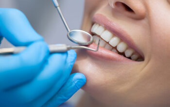 Dental implants can be extremely important to your oral health as well as other things. Read here exactly how dental implants work.