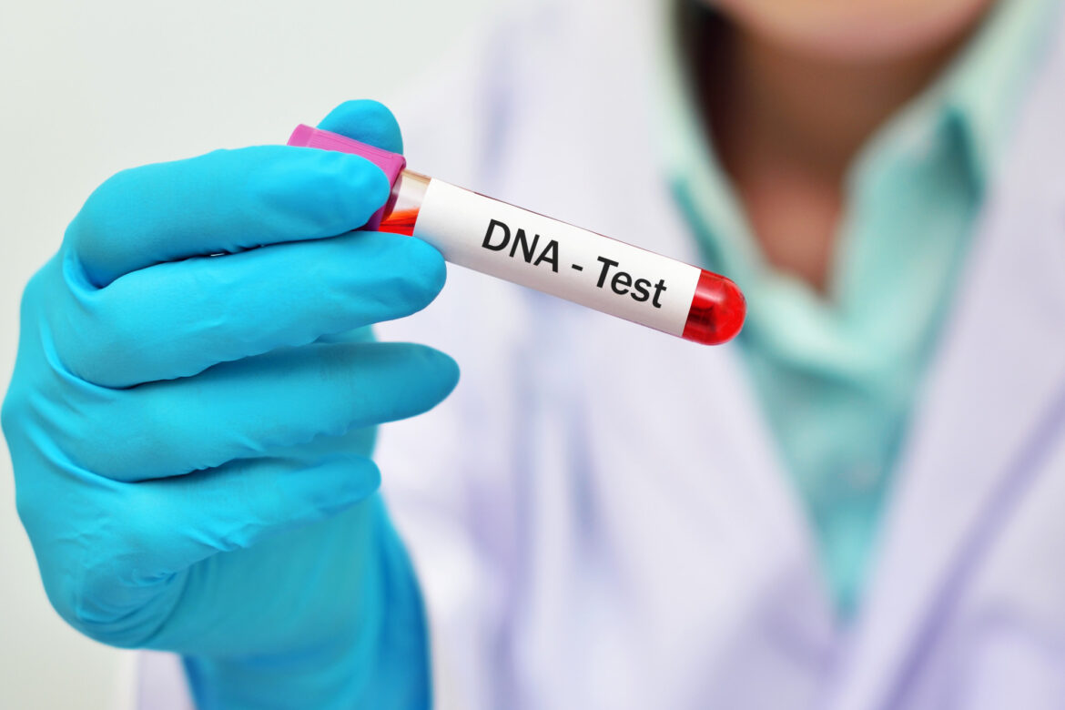 How Does a Home DNA Test Work?